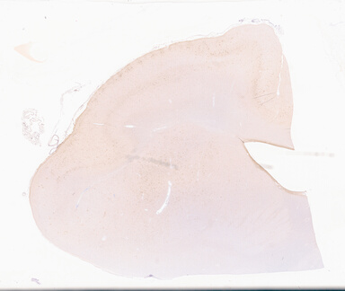 ['deident_179e093d-1cf2-49b7-b673-37b8849ec41f_69d94d68.jpg']