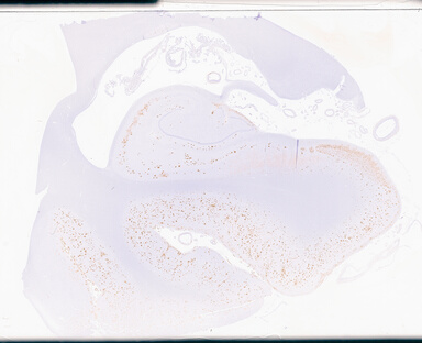 ['deident_16d5223b-916e-416c-9fc5-2c113ecfe8df_69d94d67.jpg']
