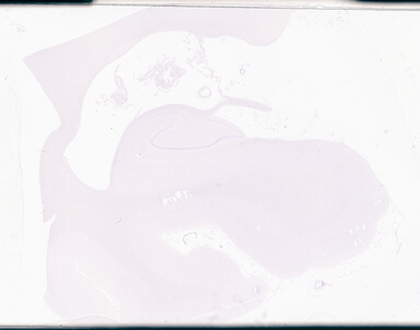 ['deident_e2347d46-3665-4b04-bf4a-fb5a8d30ab38_69d94dc8.jpg']