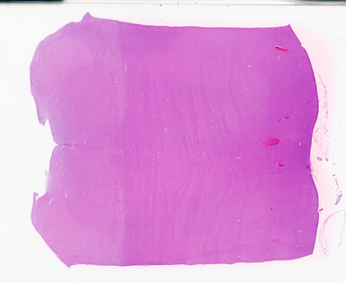 ['deident_83d8c9c9-8279-4561-b08f-e41496dcdfca_69d94da9.jpg']