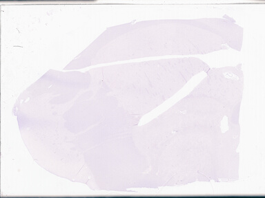 ['deident_e89a7b85-c789-4d8b-bcce-642aa719e03e_69d94dce.jpg']