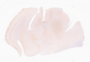 ['deident_33402548-f9a1-4139-a484-c61b3d88d01e_69d94d72.jpg']