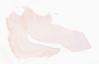 ['deident_21d7ed0f-8d31-43f4-8796-fdf125a65f75_69d94d6f.jpg']