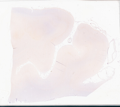 ['deident_6bd7ad6b-a593-48a3-92ae-7b88d8d2fd8e_69d94da0.jpg']