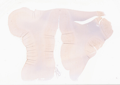 ['deident_18252fc1-7dc1-411e-baf9-59bf959a0989_69d94d6a.jpg']