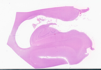['deident_69ab3fb7-9fd3-4843-993d-034475d2f0c5_69d94d9c.jpg']