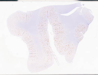 ['deident_acae3aea-d49e-461b-b3cd-ed7684490230_69d94db8.jpg']