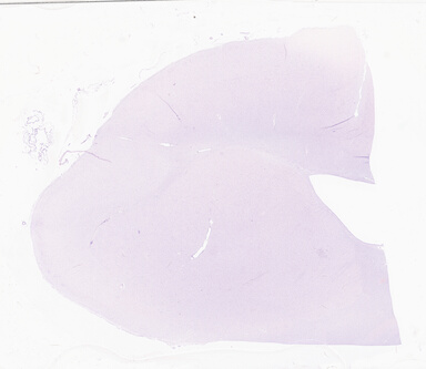 ['deident_cef24e44-54d5-4511-ba97-0f9731176fbe_69d94dc1.jpg']