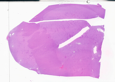 ['deident_5342f353-ff0d-4cc5-9903-17c078e26252_69d94d8e.jpg']