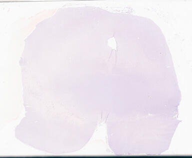 ['deident_e3dd8397-e583-4782-b82b-eab183358016_69d94dcc.jpg']