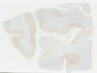 ['deident_44278c91-cf6f-4ed7-9e3e-6e74122874b3_69b0485f.jpg']