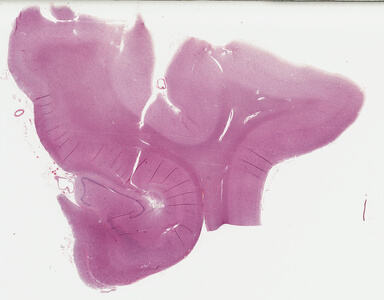 ['deident_94bf7039-857d-43bb-955a-c717ed20be9d_69b0486f.jpg']