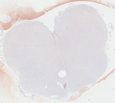 ['deident_dd83bd34-b234-44c9-acaf-8b9e119f1630_69b04881.jpg']