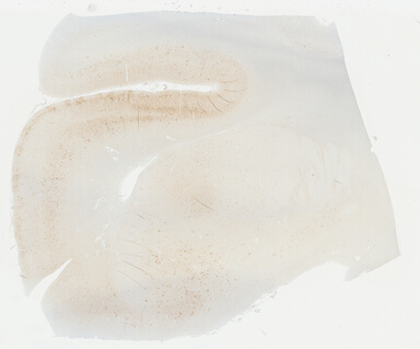 ['deident_58dc904f-89d5-4c83-bab5-8115e7cb7b1e_69b04864.jpg']