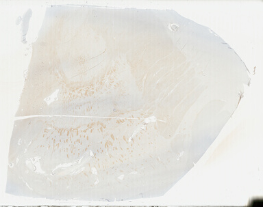 ['deident_120c8845-76eb-4844-96f4-ba106e0a76c6_69b04851.jpg']