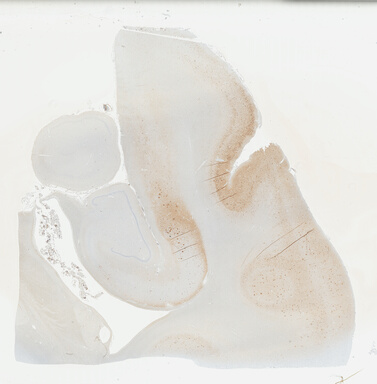['deident_6e61cc6d-72fd-4902-95c1-b03129d3f9ce_69b04868.jpg']