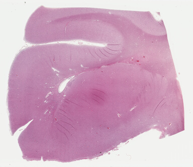 ['deident_e1a8dde8-6fdd-4814-867d-0bfafe14e4e2_69b04883.jpg']