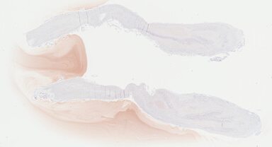 ['deident_e9da0db9-822c-44d0-a633-1dfae5ba6ac8_69b04886.jpg']
