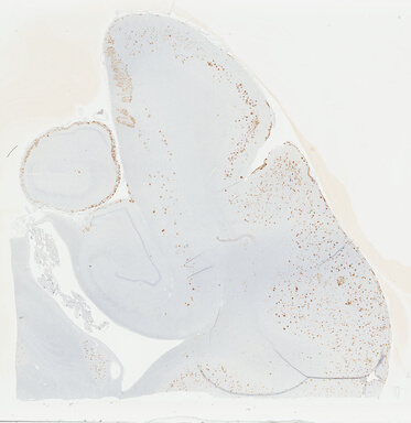 ['deident_dc292f8a-bc7f-4cef-a68a-06c30ad2957d_69b04880.jpg']