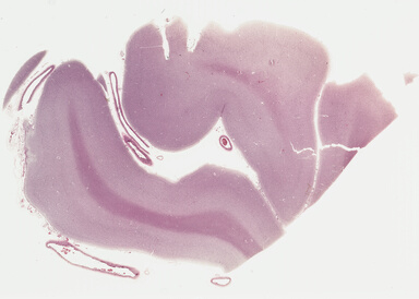 ['deident_3ba0bb0d-0dd0-4c93-bbb2-610d3fb92908_69b0485c.jpg']