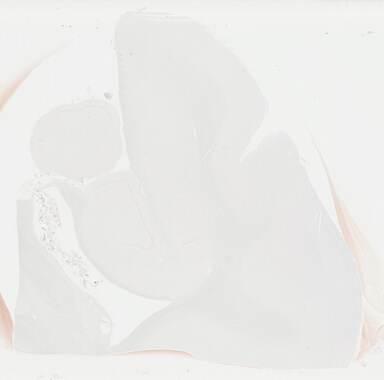 ['deident_045e7803-7626-42c0-b34f-97b1de6ce925_69b04848.jpg']