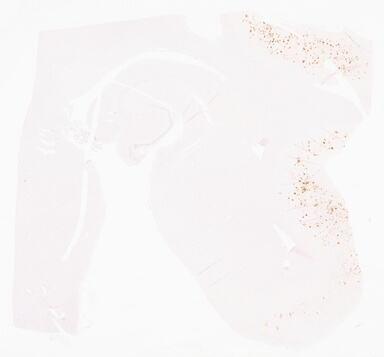 ['deident_36a602f8-db62-44e5-ab6e-1e24937dead9_69d967f8.jpg']