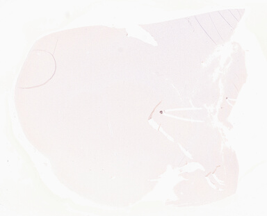 ['deident_a3eddb73-21d8-4f3e-a93f-e0b676042bb8_69d96823.jpg']