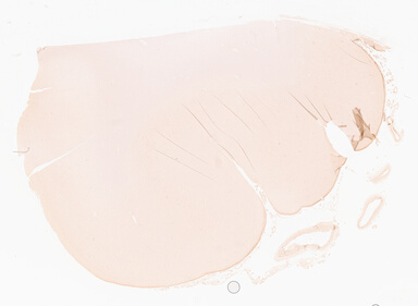 ['deident_1d5d9518-33fa-400c-af2c-ad93753b1756_69d967e9.jpg']