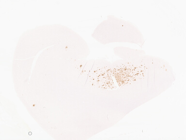 ['deident_731e8d68-de1b-49f4-aeea-d1759d0018ed_69d96817.jpg']