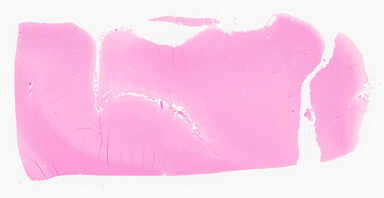 ['deident_07c0ed7b-a5b3-4272-aaf6-5a917c91ea59_69d967de.jpg']