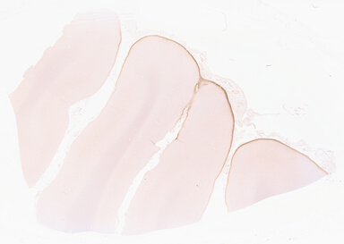 ['deident_490eaf8c-36b7-4a15-88ab-37ab0a8d77fc_69d967fd.jpg']