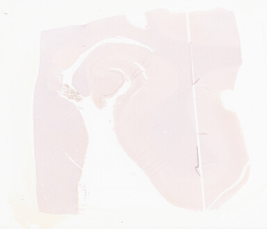['deident_4e4fa08d-2e4b-4483-b76c-4bf1d07c2b4f_69d96803.jpg']