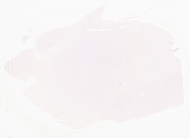 ['deident_5b1ce11d-d7b7-4b44-88db-f12d63d485c4_69d96809.jpg']