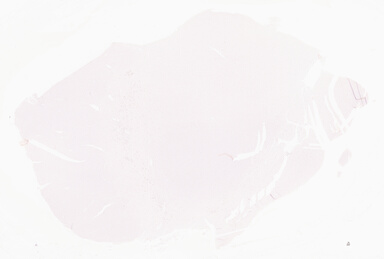 ['deident_933afd48-a39b-4135-95fa-eec46c5fa372_69d9681f.jpg']