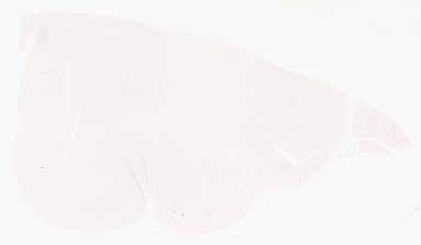 ['deident_5e9c41eb-9ca9-4dd4-a6af-25ecd902de18_69d9680d.jpg']