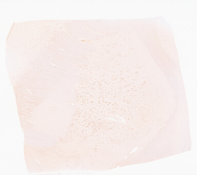 ['deident_2e23122d-0c46-4847-bde4-f18309bb33bf_69d967f2.jpg']