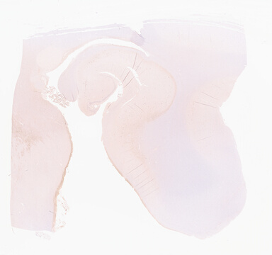 ['deident_3b5814c0-38b1-452b-b32d-61097deda22f_69d967fc.jpg']