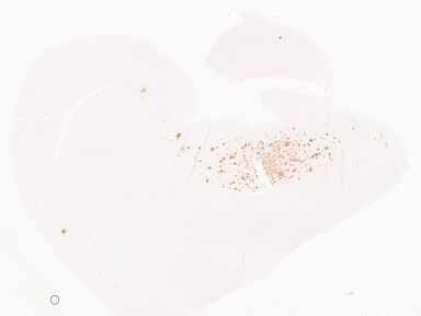 ['deident_c0dac982-471c-4ac1-b717-2e398473afa9_69d96830.jpg']