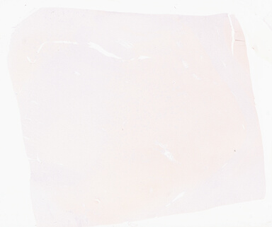 ['deident_c84e5681-bb27-4909-9b47-0310a82c4492_69d96839.jpg']