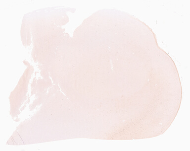['deident_9b332240-9224-440e-b844-746c92134e49_69d96821.jpg']