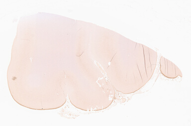 ['deident_182f18d4-5bdc-43f7-9d40-e4d1e494233b_69d967e7.jpg']