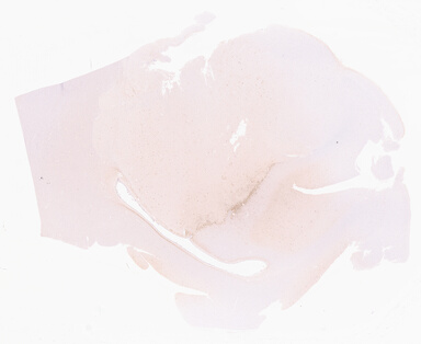 ['deident_355f4f1a-5261-484d-ad0d-f366b59de59f_69d967f7.jpg']
