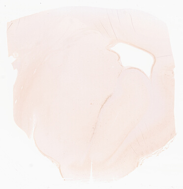 ['deident_cba52ae9-10bd-490c-bbc0-e19ab101c636_69d96841.jpg']