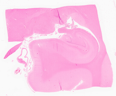 ['deident_bc84fc3c-e075-4d7c-994f-a0a032989810_69d9682e.jpg']