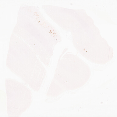 ['deident_cca31e84-4770-4594-9a05-88c2f1c7e026_69d96843.jpg']