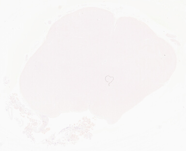['deident_acb7b6e5-eb9c-42d9-baaa-f2ea051268e8_69d9682a.jpg']