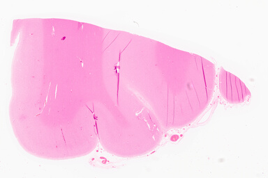 ['deident_e1fd7fec-aa24-4470-b309-dcfcebe678d9_69d96846.jpg']