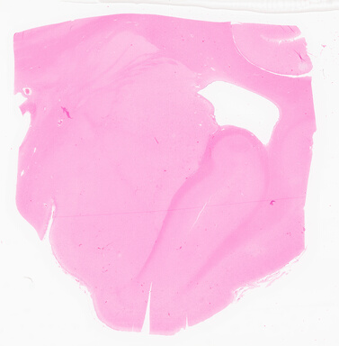 ['deident_ae380edc-42d8-42b7-b2d7-368b33ac98d3_69d9682b.jpg']