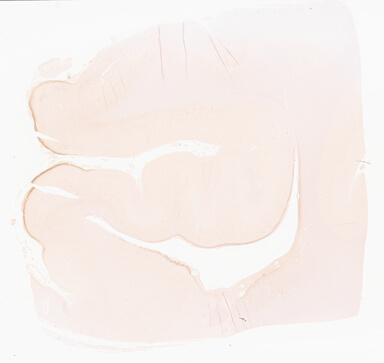 ['deident_67eab48f-c851-4e6e-9c3b-a7a87889bc03_69d96812.jpg']