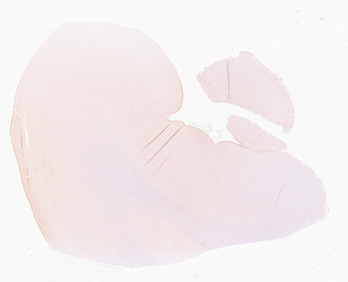 ['deident_dc9db18d-25c0-4953-ab91-70dd94362176_69d96844.jpg']